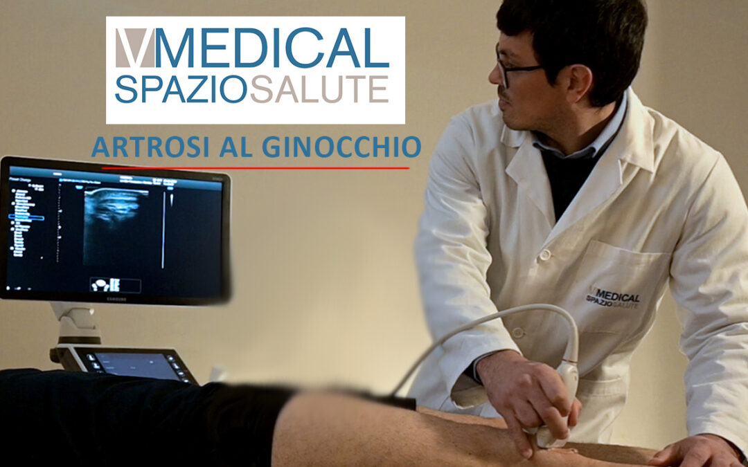 Il dolore al ginocchio… potrebbe essere artrosi!